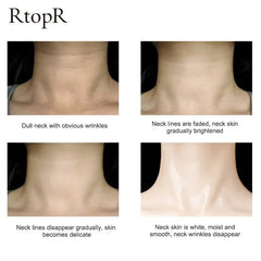 Neck Firming Wrinkle Remover Cream Rejuvenation Firming Skin Whitening Moisturizing Shape Beauty Neck Skin Care Products