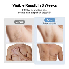 Laser Hair Removal for Women & Men, Air 3 IPL Hair Removal for Painless & Long-Lasting Result