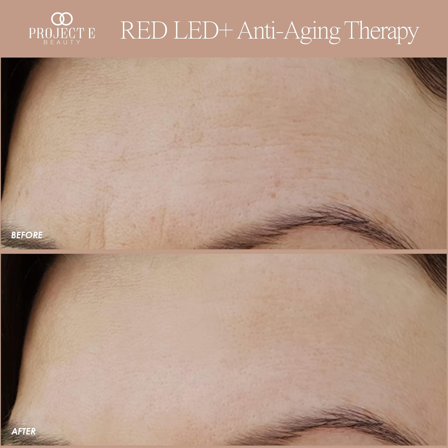 RED LED+ Anti-Aging Therapy by  | Collagen Boosting | Instant Firming and Lifting | Reduces Fine Lines & Wrinkles | Tightens & Tones | Rechargeable & Portable (Red LED Therapy)