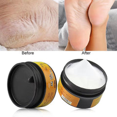 Horse Oil Feet Cream Athlete'S Foot Peeling Bad Feet Ointment Foot Care Moisturizing Skin Care Maintenance TSLM1