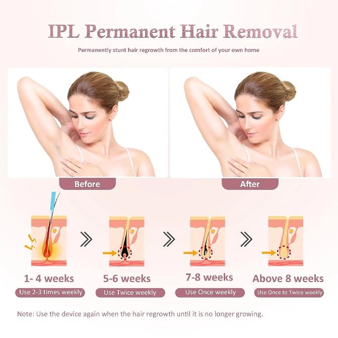 REDFMG IPL Laser Hair Removal for Women, 999,999 Flashes, 5 Levels Adjustable, Pink