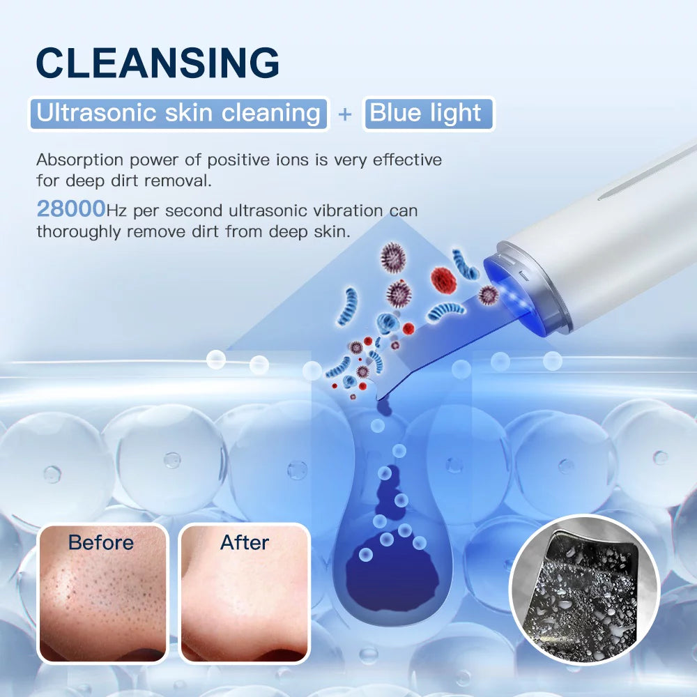 Ultrasonic Skin Scrubber Blue Light Skin Care Deep Face Cleaning Peeling Shovel Facial Pore Cleaner Facial Lifting Machine,White