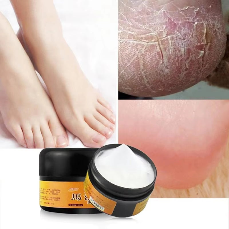 Horse Oil Feet Cream Athlete'S Foot Peeling Bad Feet Ointment Foot Care Moisturizing Skin Care Maintenance TSLM1