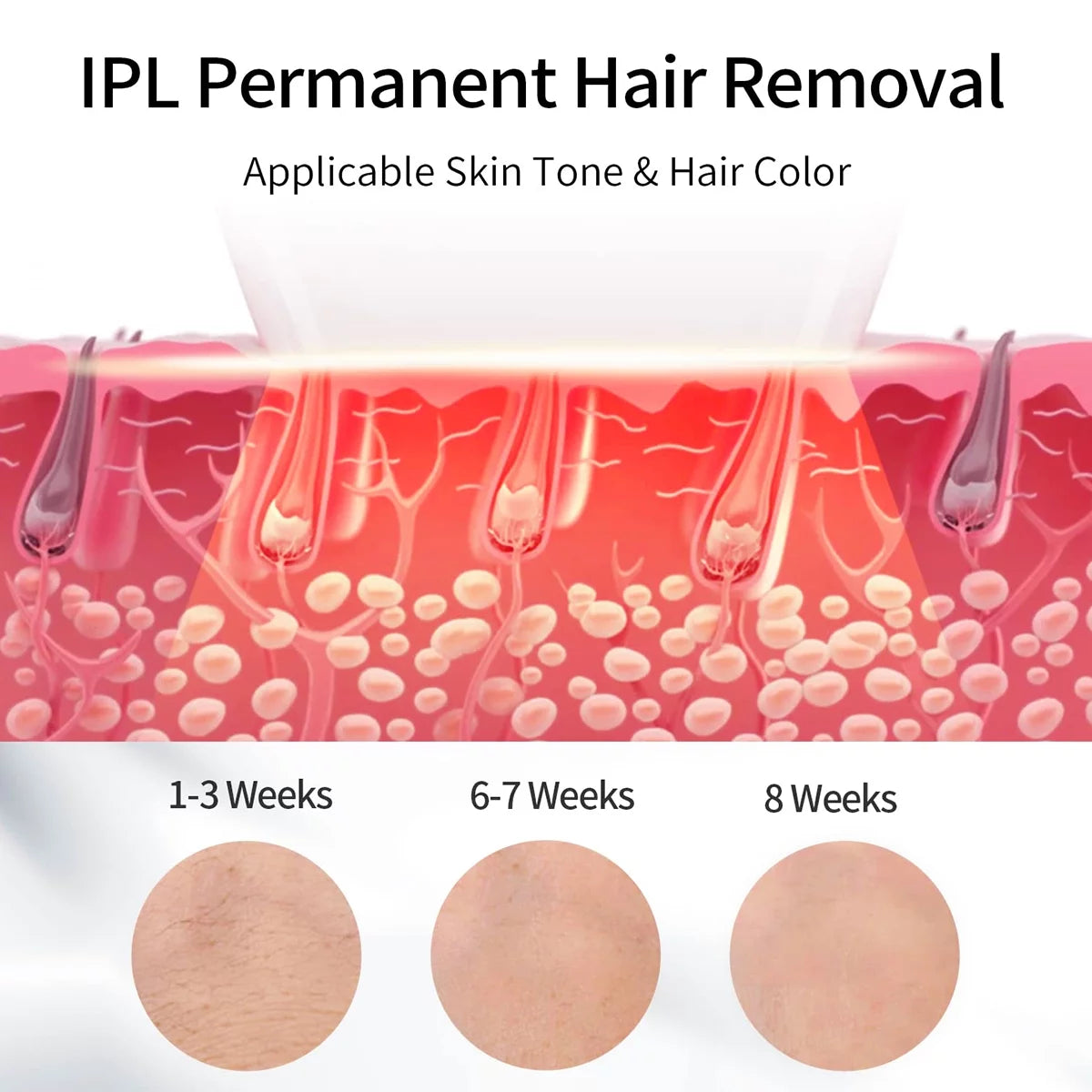 IPL Hair Removal for Women, Permanent Laser Hair Removal 999,900 Flashes, at Home Use Painless Hair Remover on Whole Body for Women Face Body Bikini,Hair Treatment Home Use