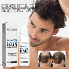 Hair Growth Treatment Serum Minoxi Roll-On Regrowth Nourishing Hair Scalp Care